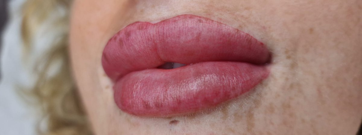 Lip blush treatment